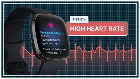 fitbit ecg watch clone|which fitbit has ecg.